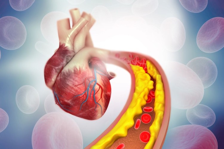 Cholesterin verstehen
